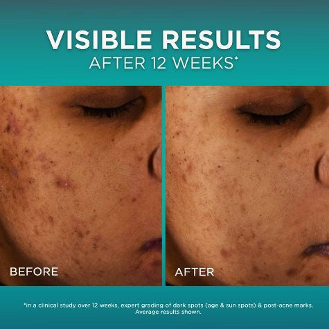 L’Oreal Bright Reveal Niacinamida Suero