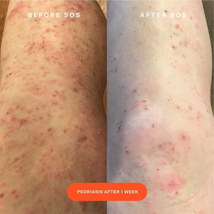 Tower 28 S.O.S(Save.Our.Skin.) Spray Facial