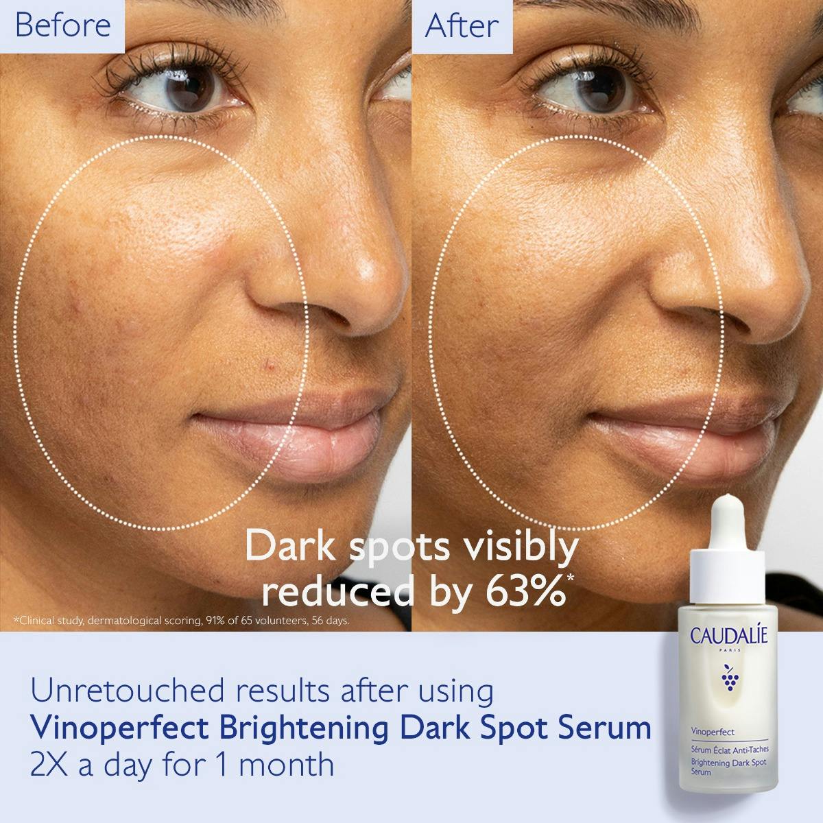 Caudalíe Dark Spot Brightening Set