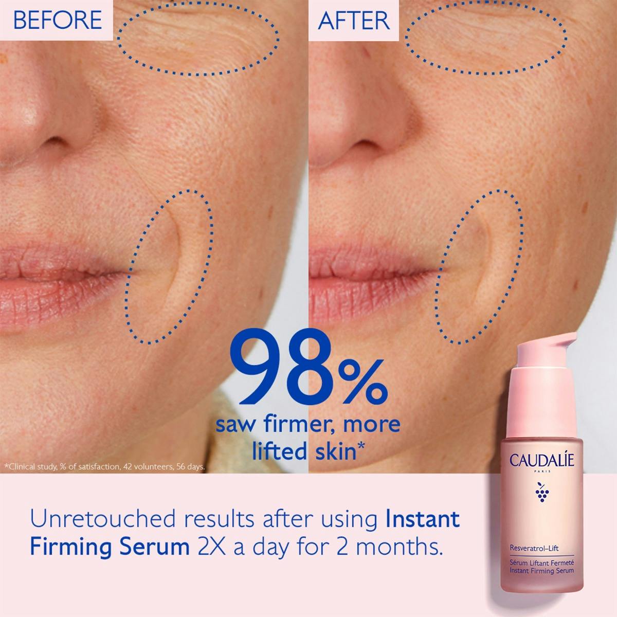 Caudalíe Firming Solution Set