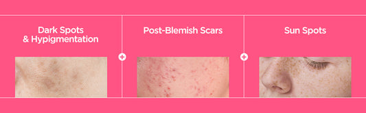 Anua Niacinamida 10% + TXA 4% Serum