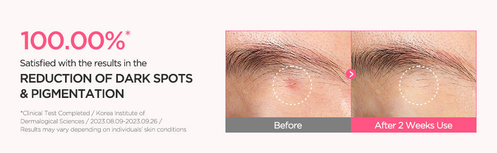 Anua Niacinamida 10% + TXA 4% Serum