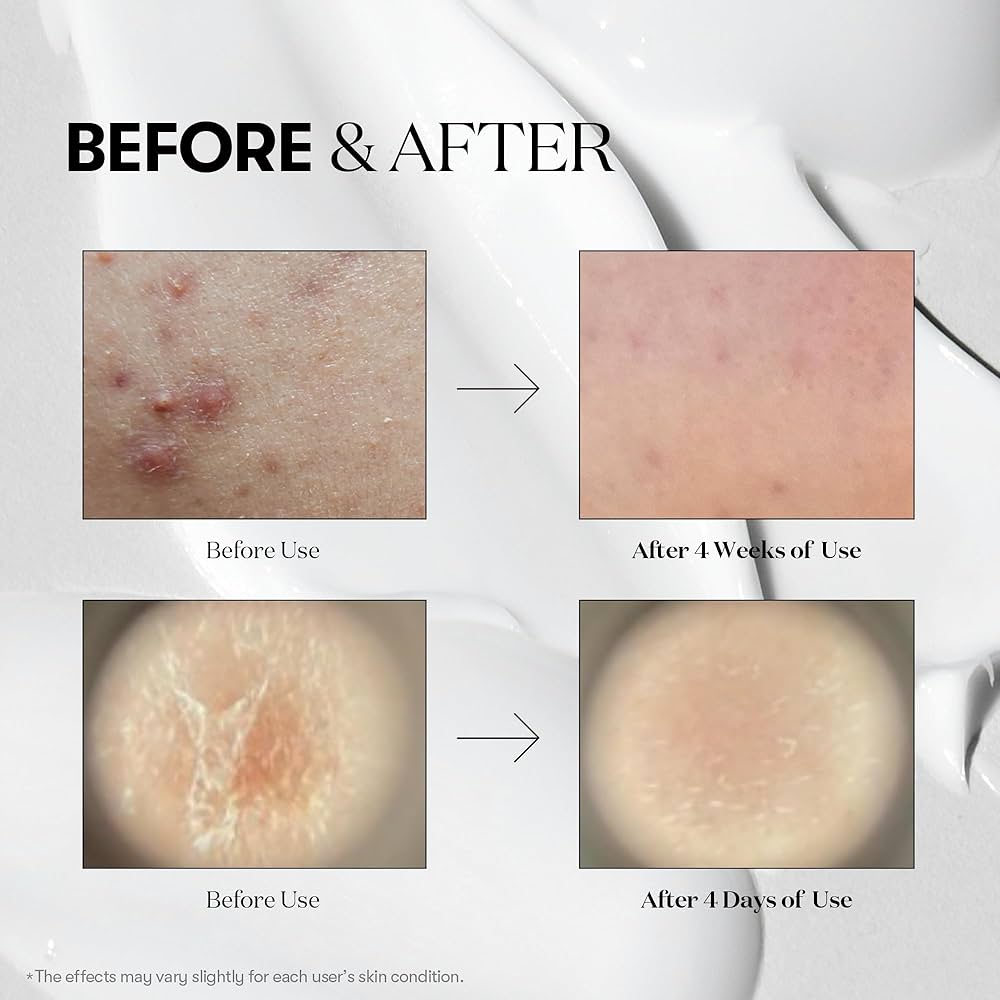 VT Cosmetic Mild Reedle Shot CicaxHyalon