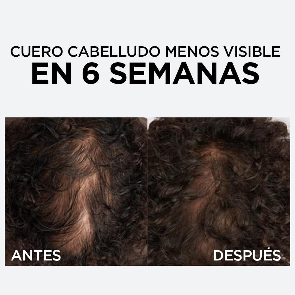 L'Oreal Elvive Caída Resist Sérum