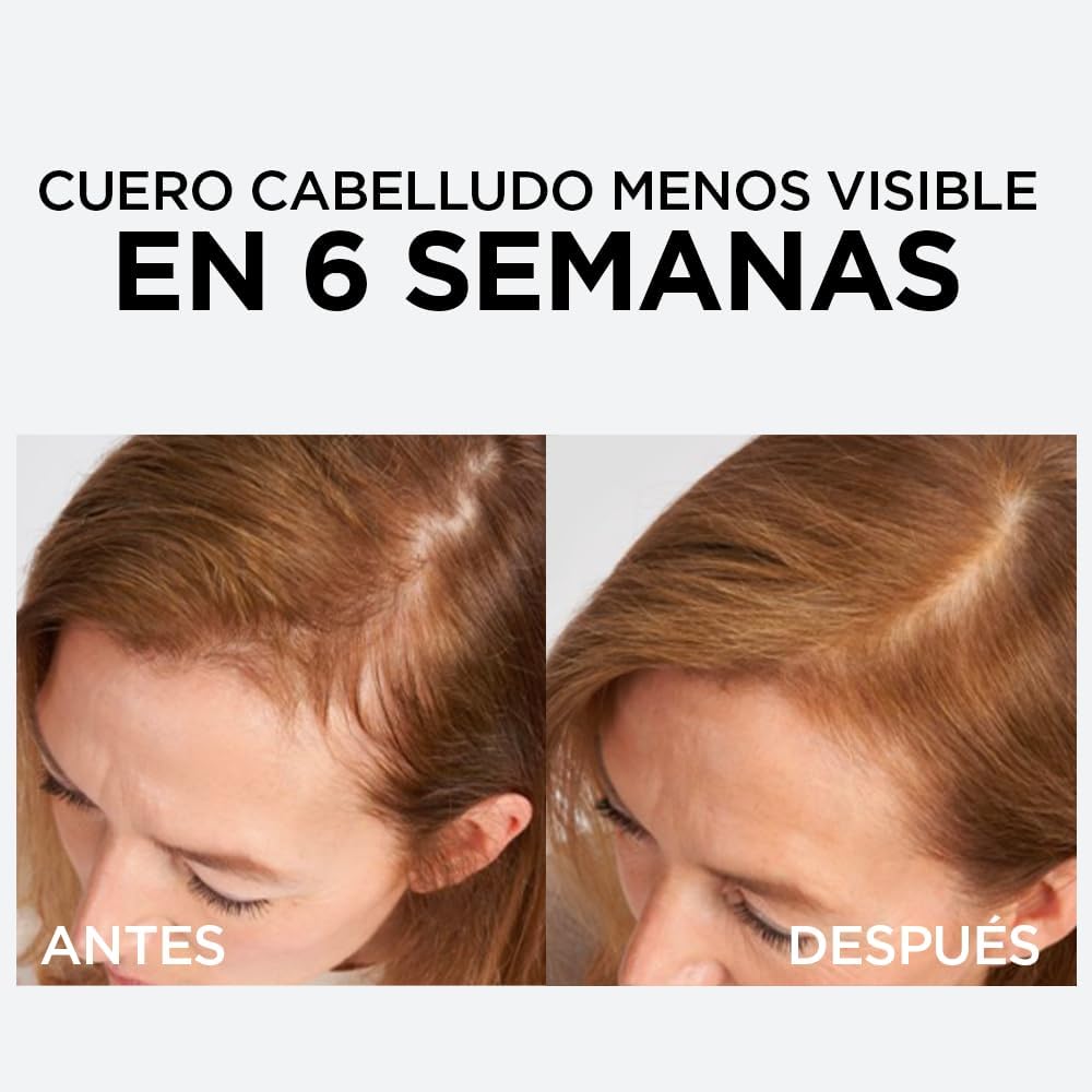 L'Oreal Elvive Caída Resist Sérum