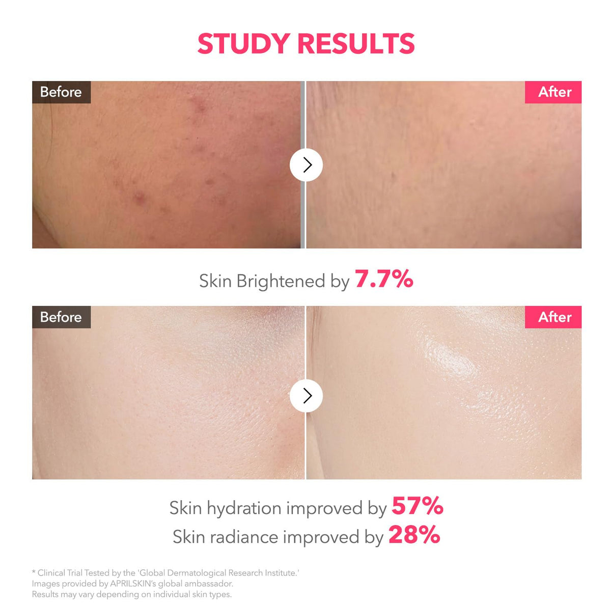 Aprilskin Gel Mask