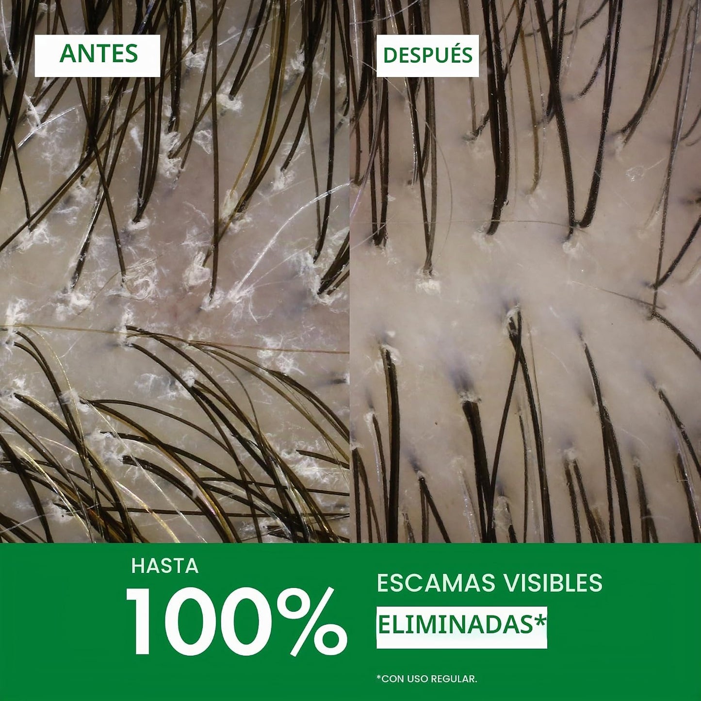 Vichy Dercos Champú para Caspa