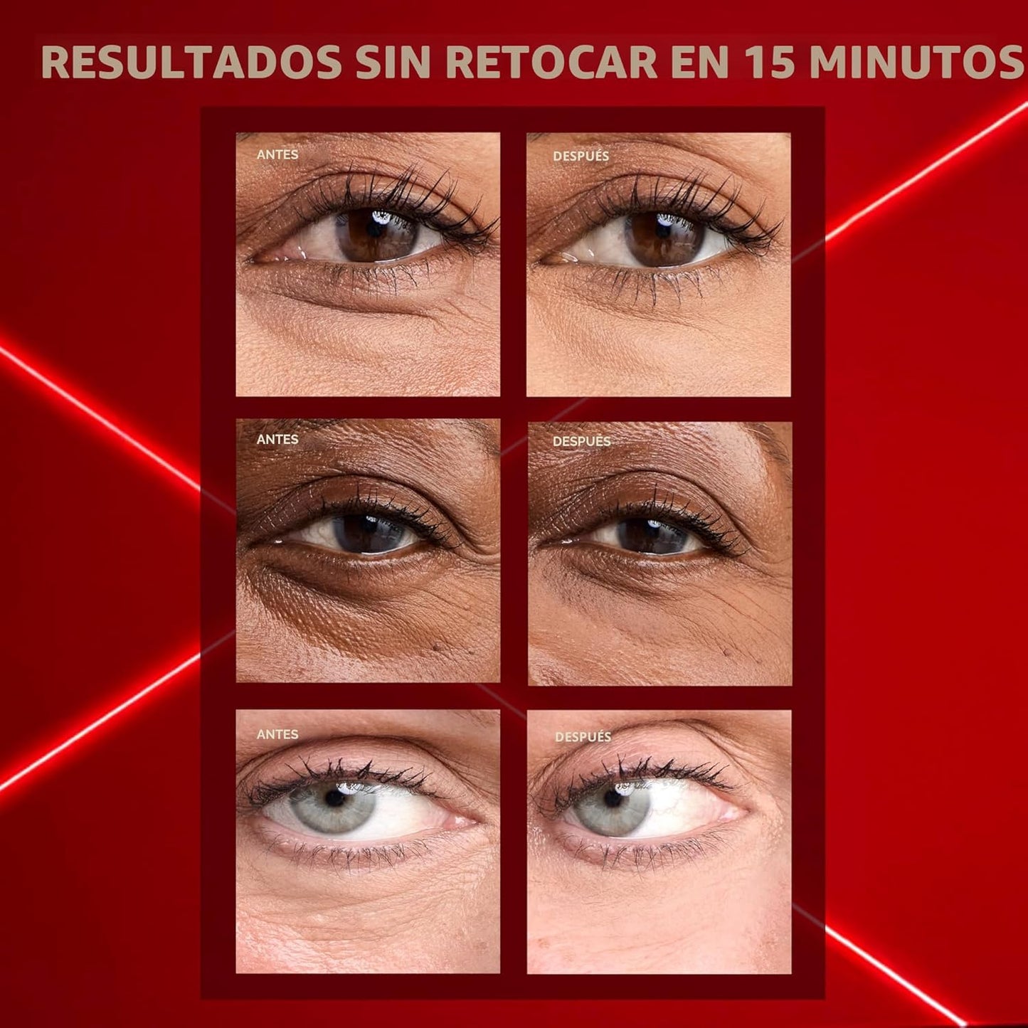 L'Oréal Paris Revitalift Triple Power Eye Bag Instant Eraser