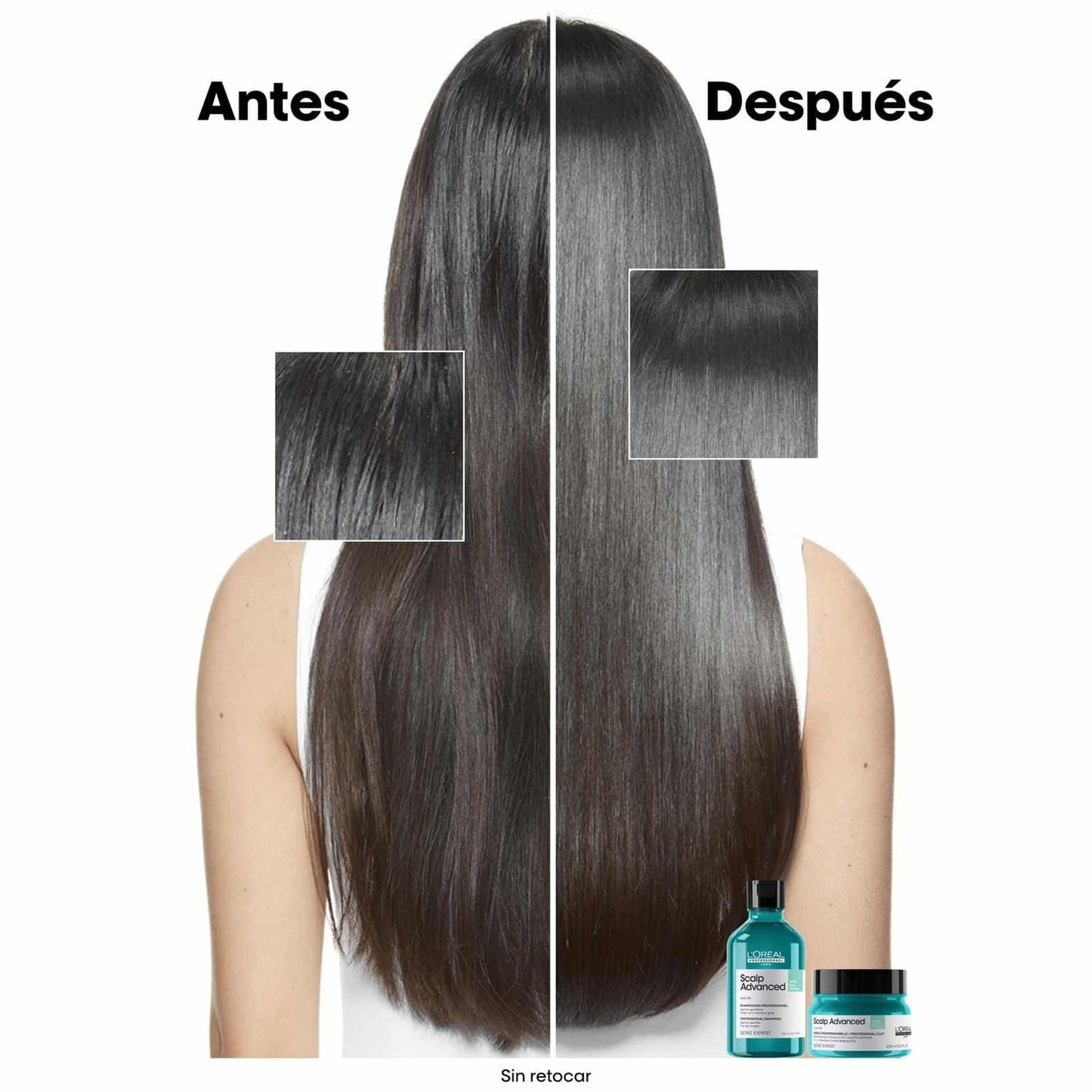 L’Oréal Scalp Advanced Shampoo Anti-grasa