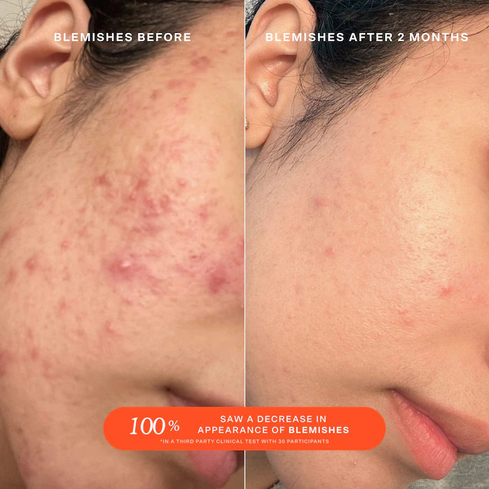 Sephora Favorites  Cozy & Clean Set